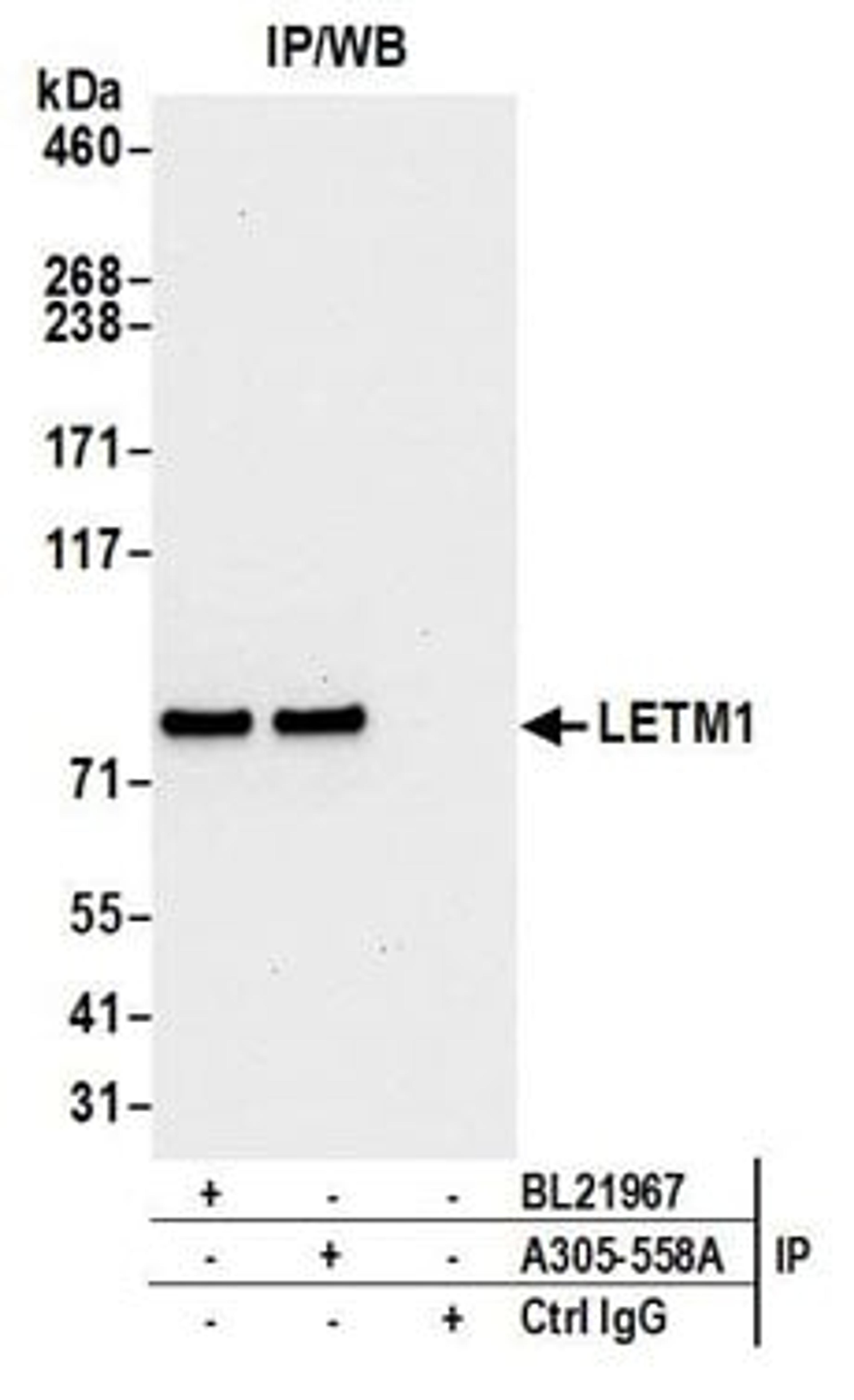 Detection of human LETM1 by western blot of immunoprecipitates.