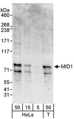 Detection of human MID1 by western blot.