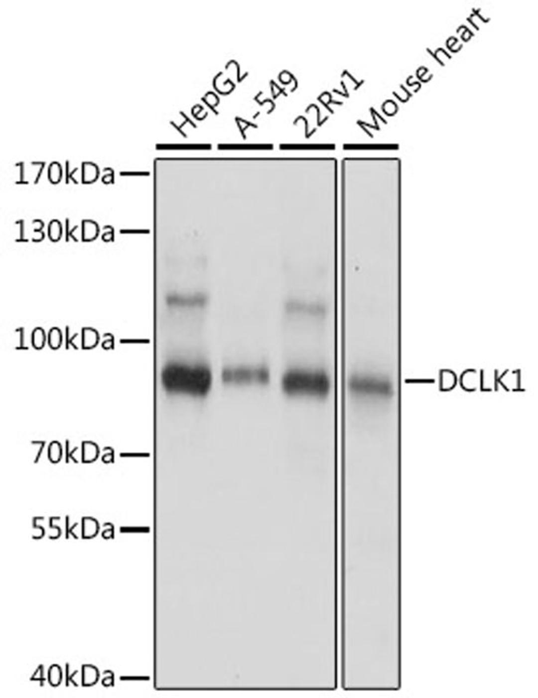 Western blot - DCLK1 antibody (A16464)