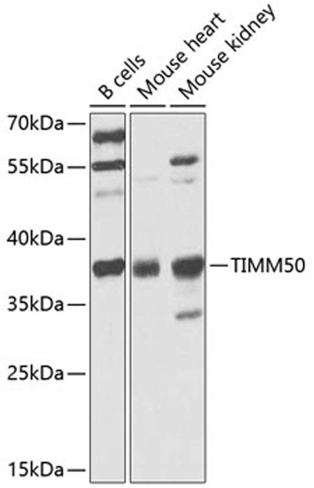 Western blot - TIMM50 antibody (A9991)