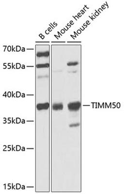 Western blot - TIMM50 antibody (A9991)