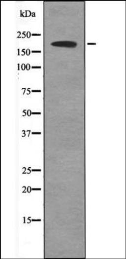 Western blot analysis of UV treated 293 whole cell lysates using BRCA1 -Phospho-Ser1497- antibody