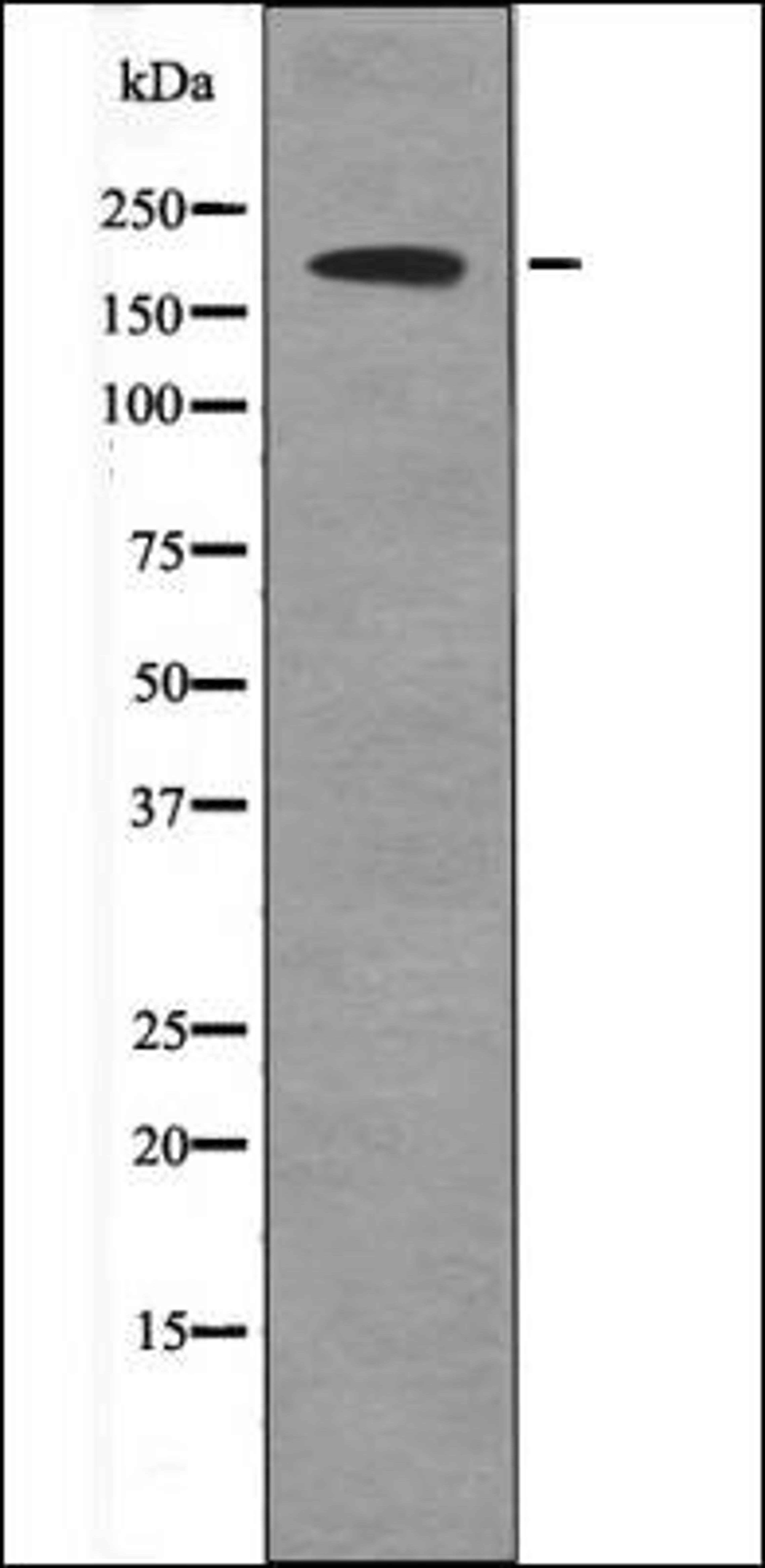 Western blot analysis of UV treated 293 whole cell lysates using BRCA1 -Phospho-Ser1497- antibody