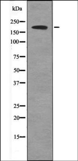 Western blot analysis of UV treated 293 whole cell lysates using BRCA1 -Phospho-Ser1497- antibody