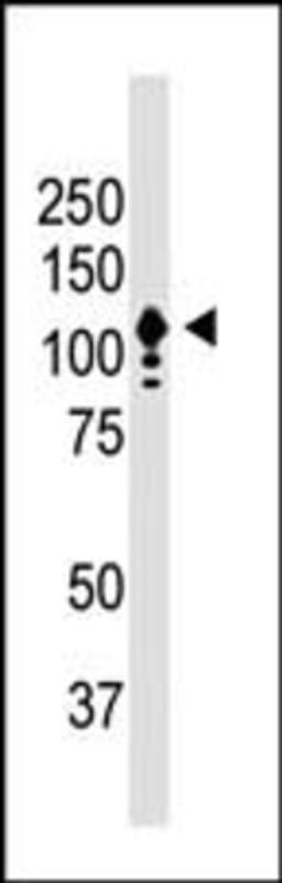 Western Blot:  CD133 Antibody [NB120-16518] - Predicted band size : 97 kDa recognizes 97 kDa human CD133 in Y79 cells. Band is at ~120 kDa due to protein glycosylation.