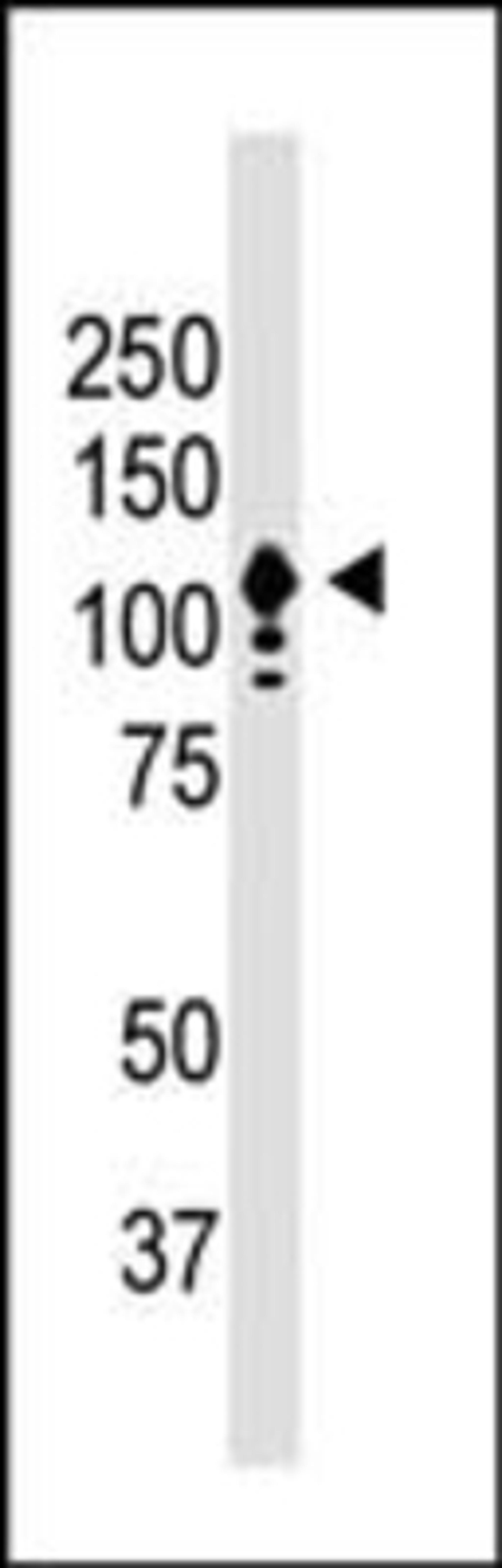 Western Blot:  CD133 Antibody [NB120-16518] - Predicted band size : 97 kDa recognizes 97 kDa human CD133 in Y79 cells. Band is at ~120 kDa due to protein glycosylation.