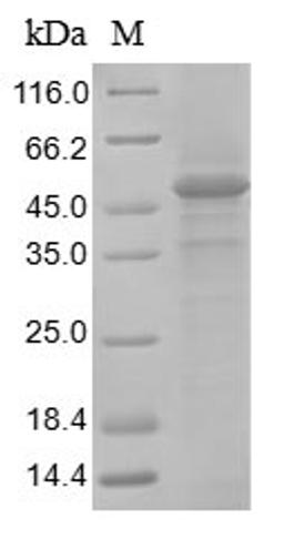 (Tris-Glycine gel) Discontinuous SDS-PAGE (reduced) with 5% enrichment gel and 15% separation gel.