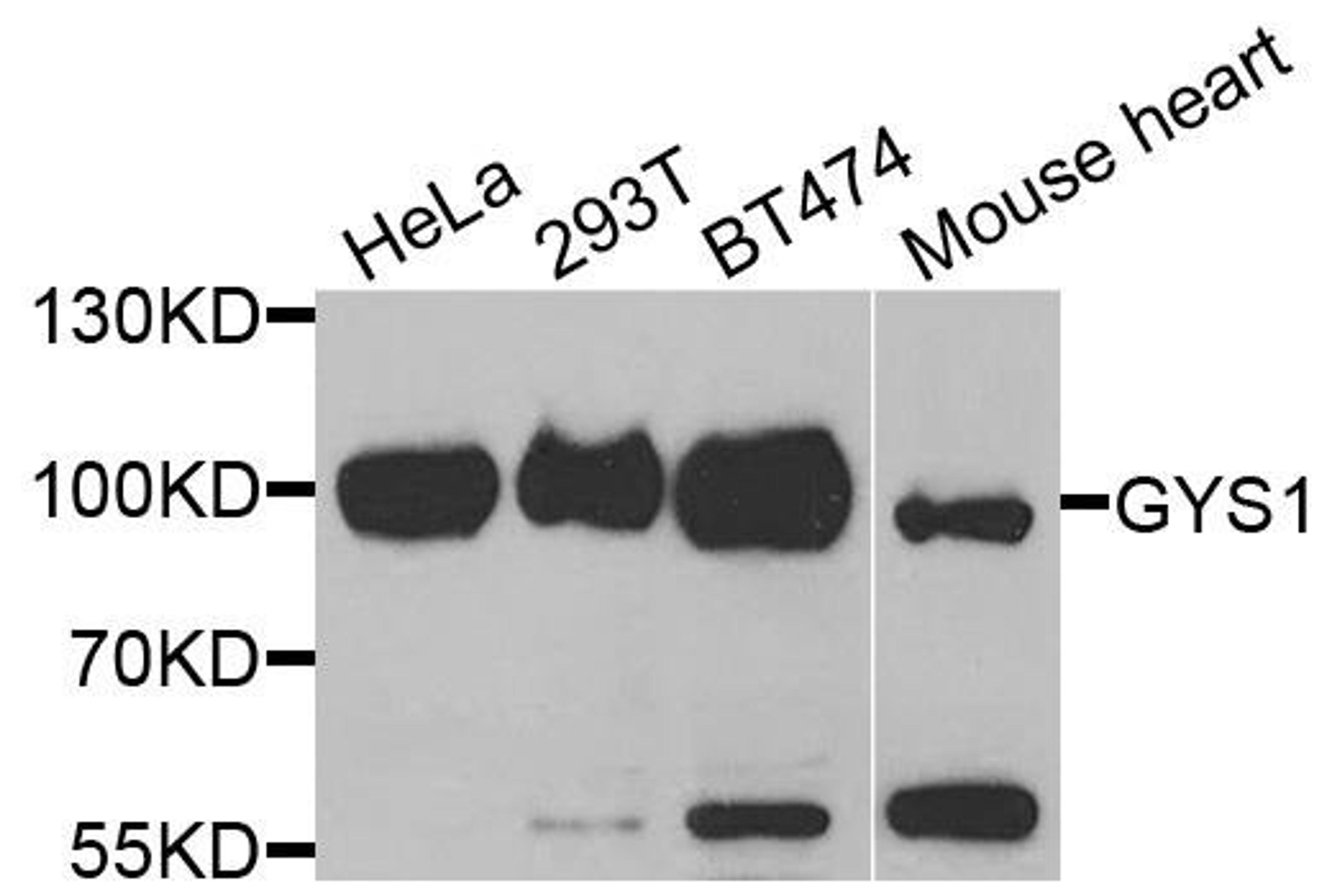 Western blot analysis of extracts of various cells using GYS1 antibody