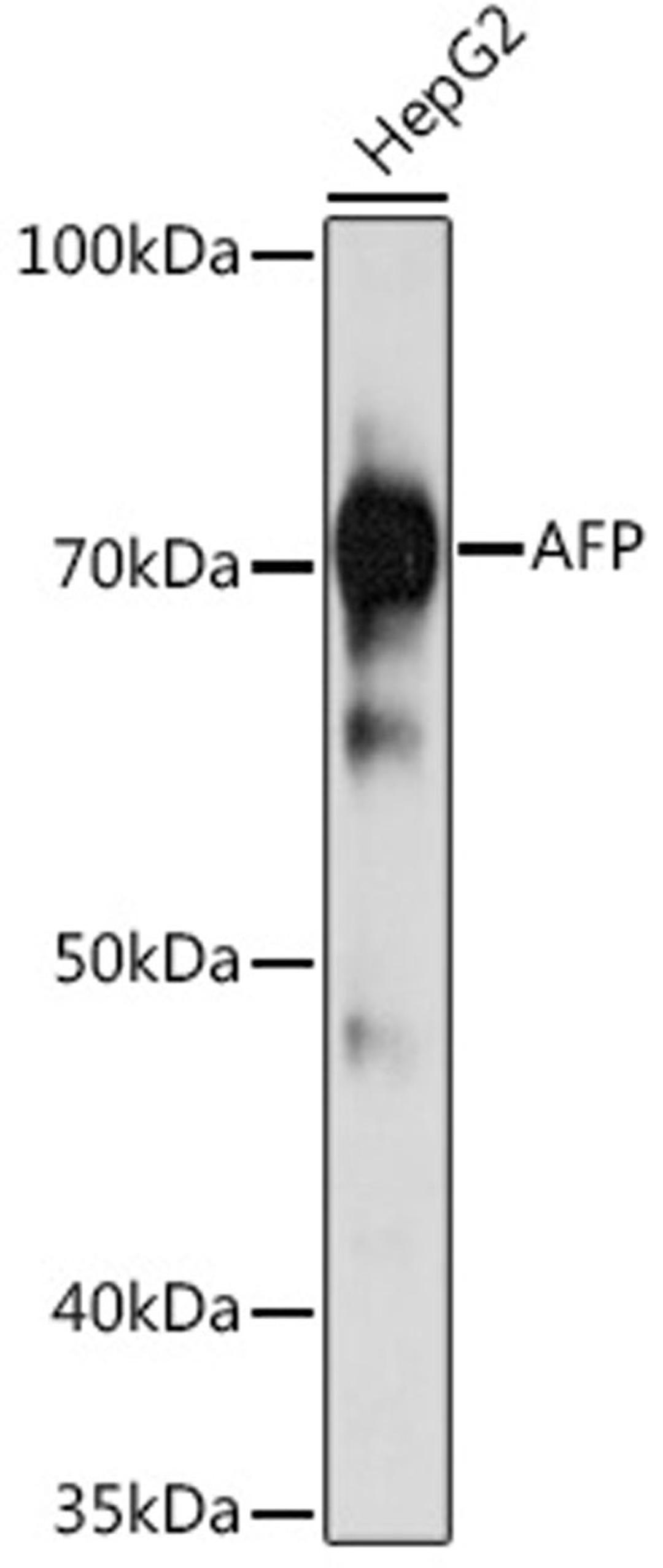 Western blot - AFP Mouse mAb (A17898)