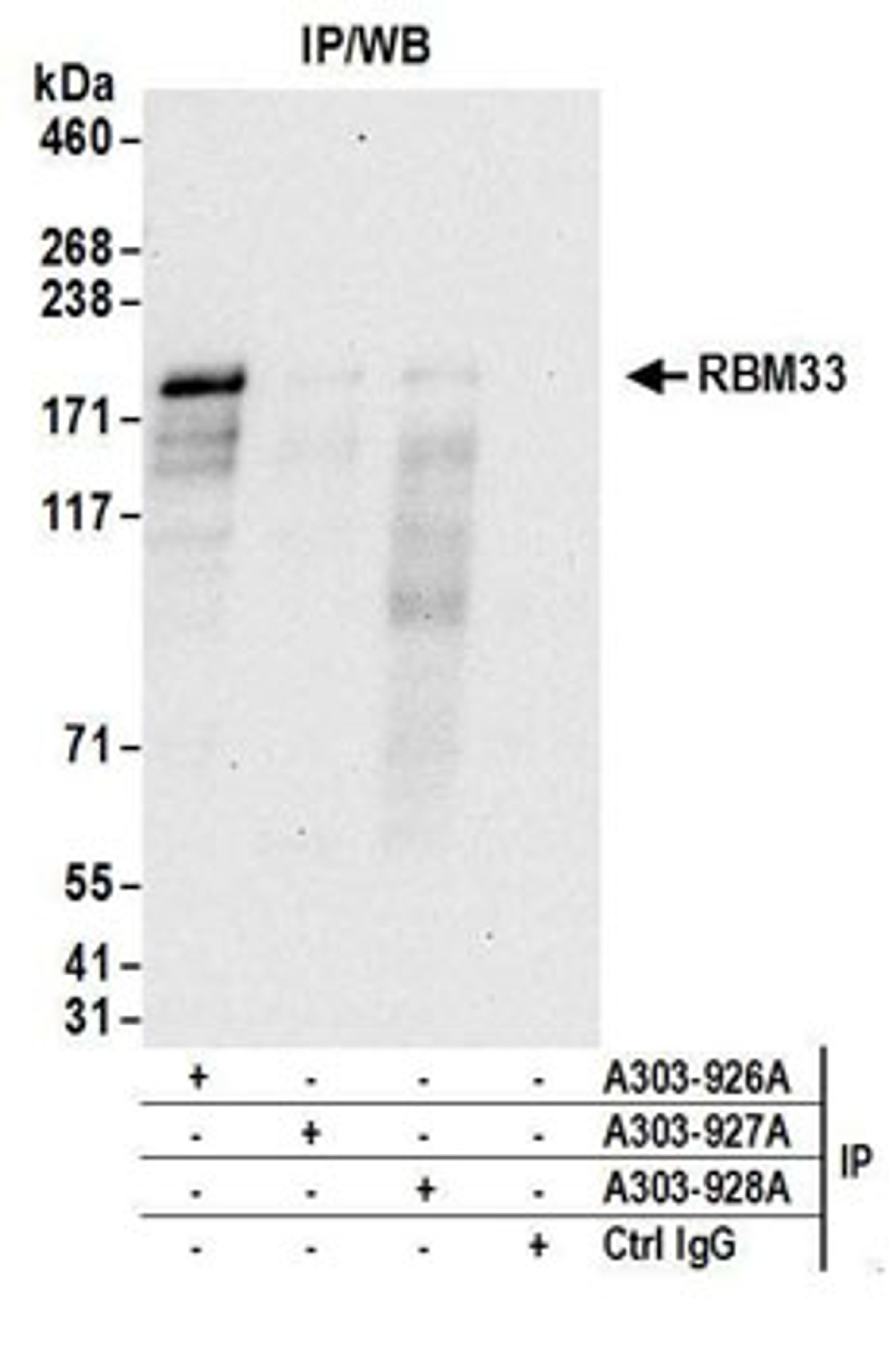 Detection of human RBM33 by western blot of immunoprecipitates.