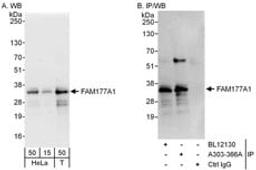 Detection of human FAM177A1 by western blot and immunoprecipitation.