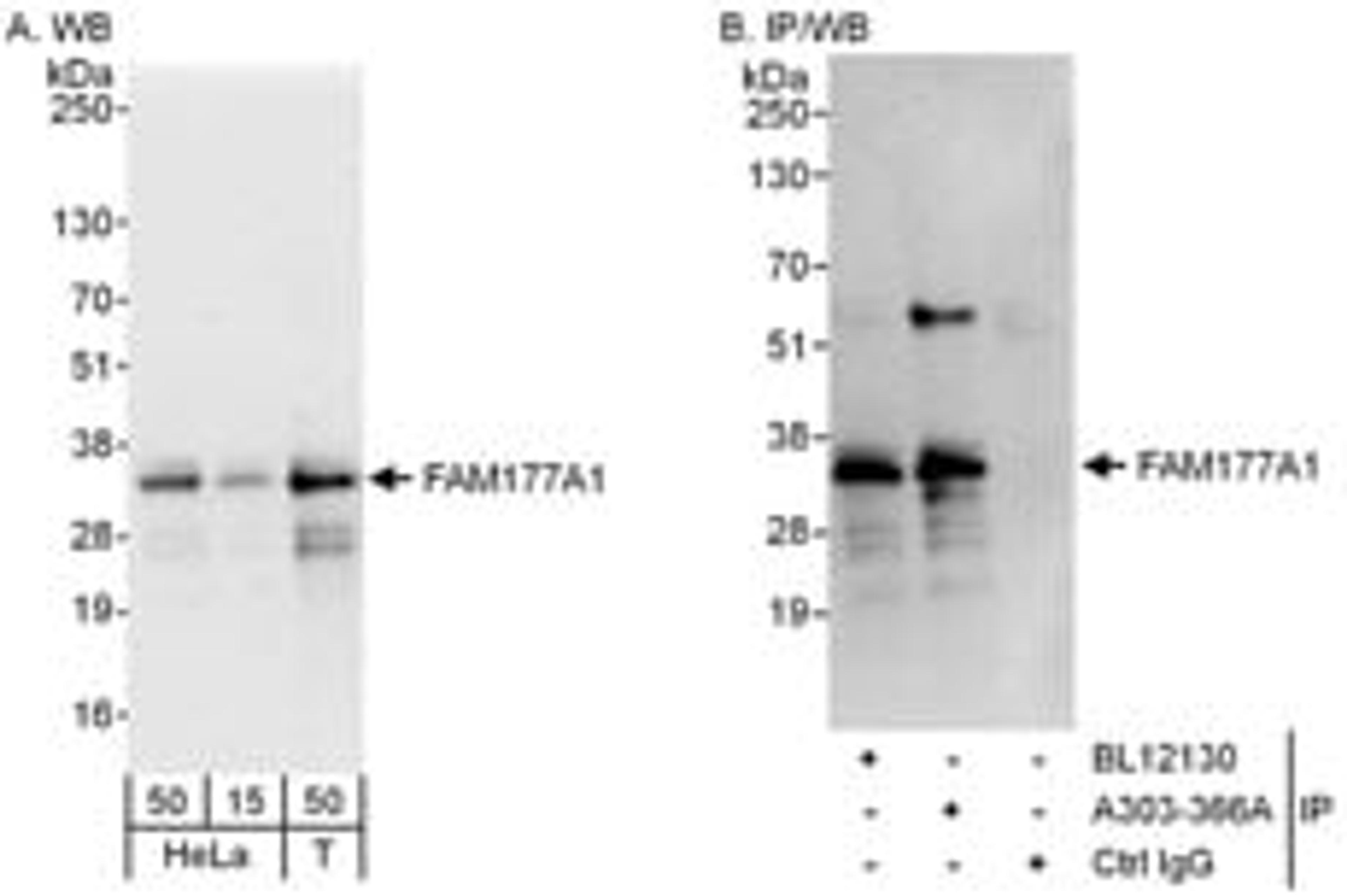 Detection of human FAM177A1 by western blot and immunoprecipitation.