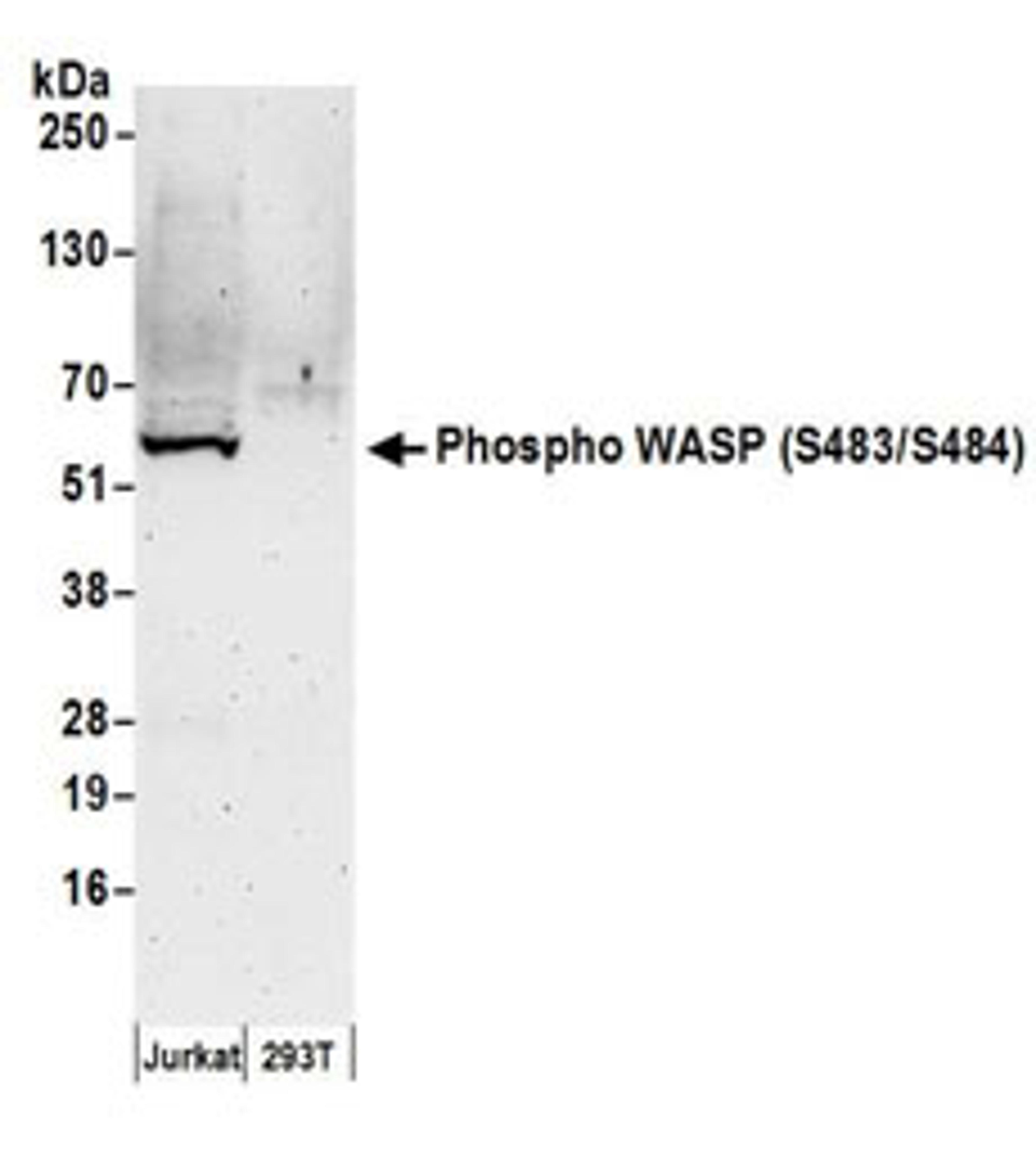 Detection of human Phospho WASP (S483/S484) by western blot.