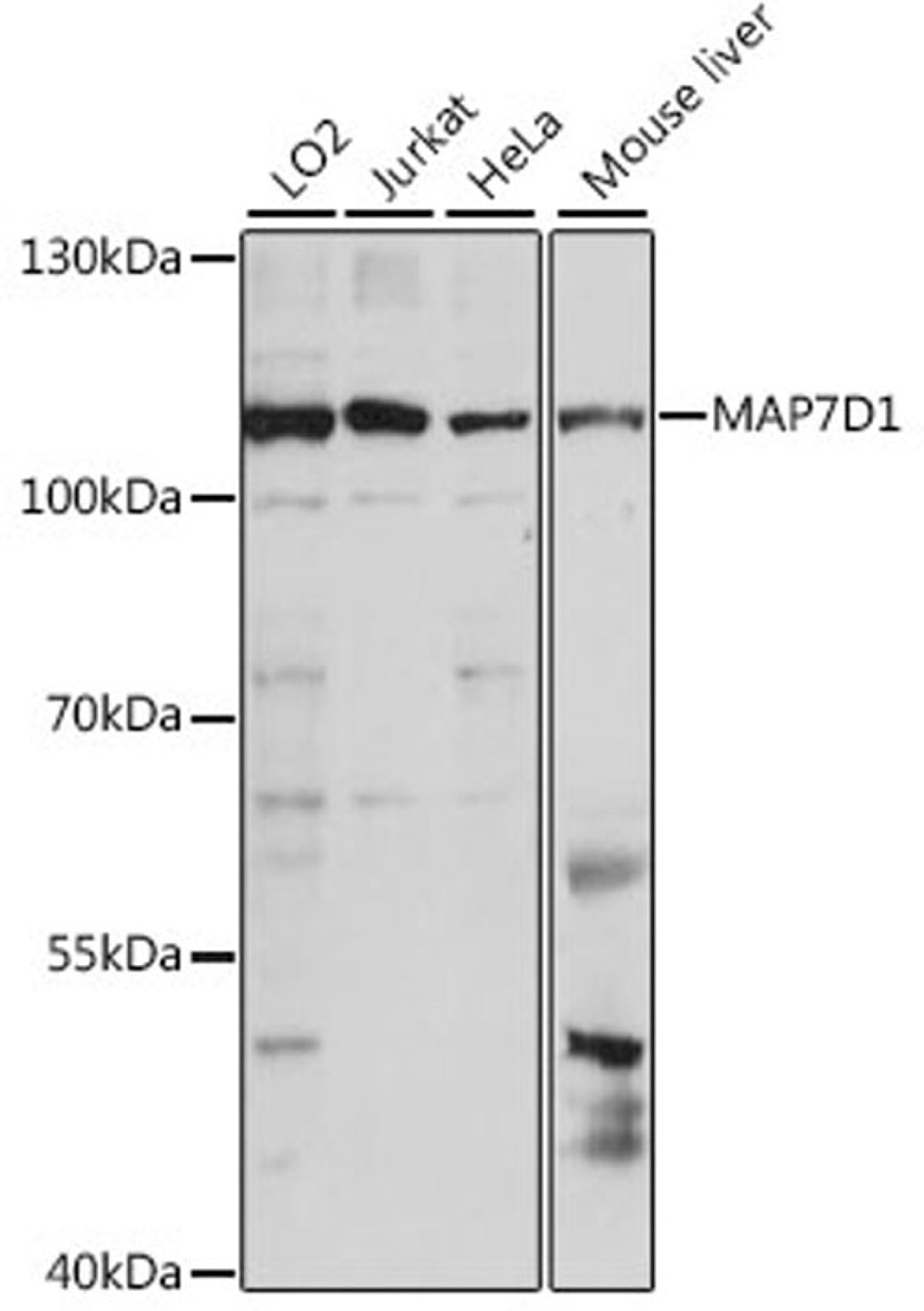 Western blot - MAP7D1 antibody (A15862)