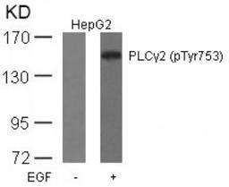 Western blot analysis of lysed extracts from HepG2 cells untreated or treated with EGF using PLC&#947;2 (Phospho-Tyr753).