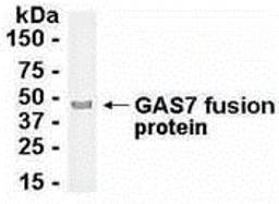 E coli-derived fusion protein as test antigen. Affinity-purified IgY dilution: 1:2000, Goat anti-IgY-HRP dilution: 1:1000. Colorimetric method for signal development.