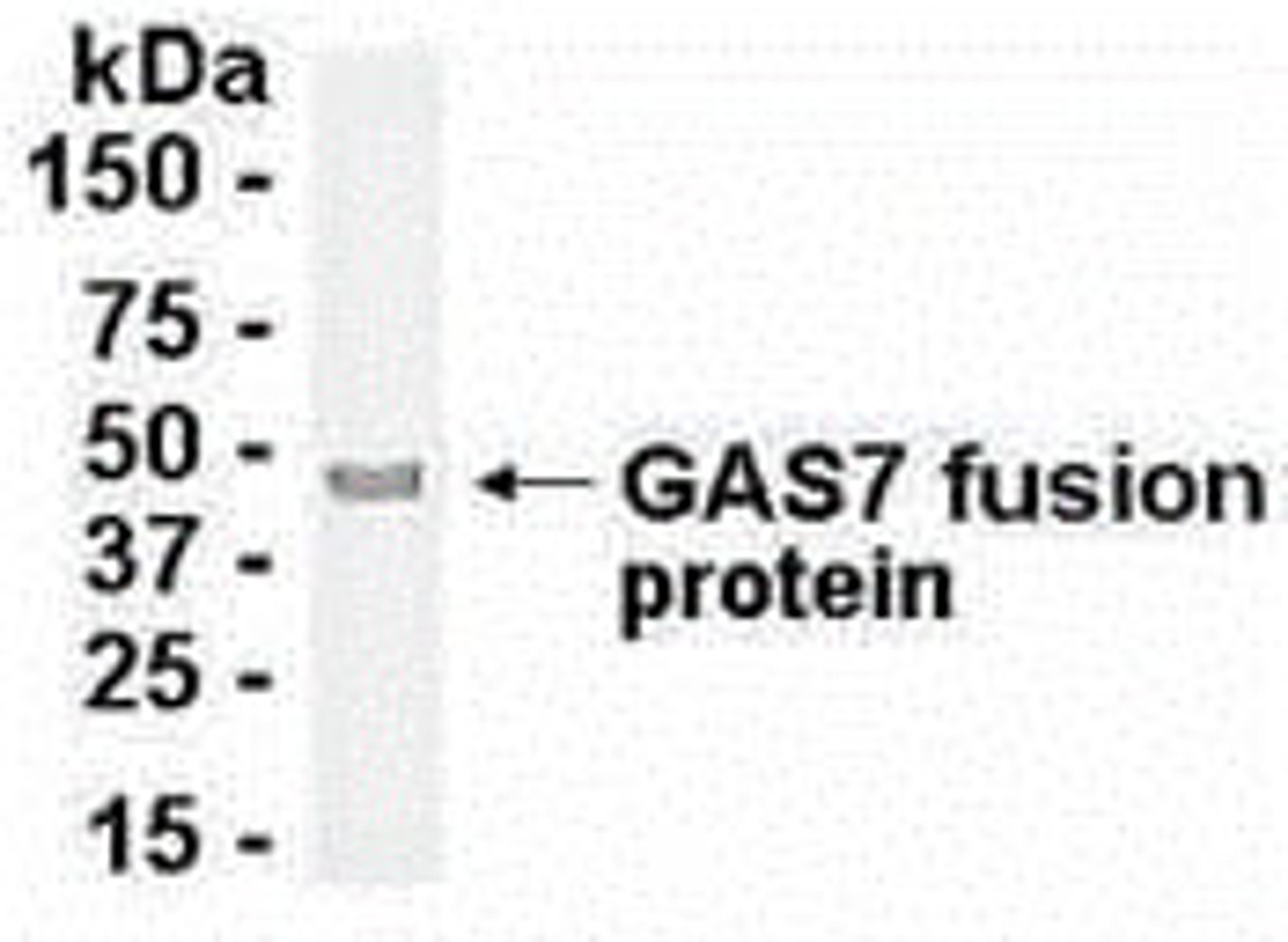 E coli-derived fusion protein as test antigen. Affinity-purified IgY dilution: 1:2000, Goat anti-IgY-HRP dilution: 1:1000. Colorimetric method for signal development.