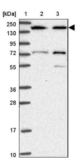 Western Blot: SBF2 Antibody [NBP2-13283] - Lane 1: Marker [kDa] 250, 130, 95, 72, 55, 36, 28, 17, 10<br/>Lane 2: Human cell line RT-4<br/>Lane 3: Human cell line U-251MG sp