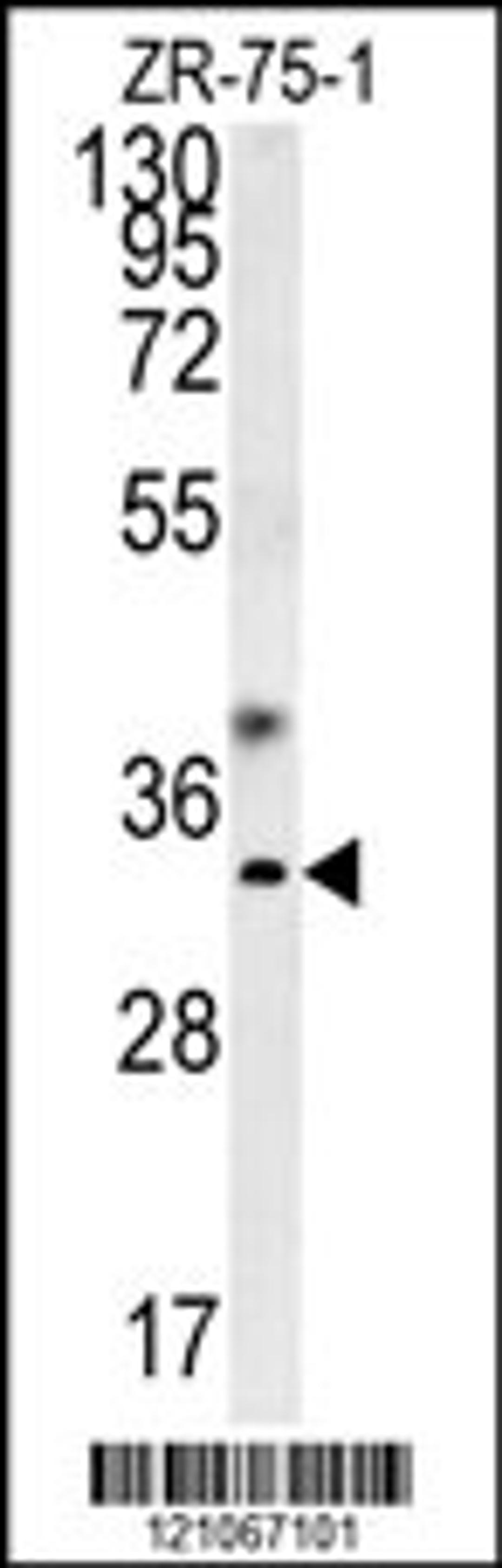 Western blot analysis in ZR-75-1 cell line lysates (35ug/lane).