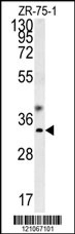 Western blot analysis in ZR-75-1 cell line lysates (35ug/lane).