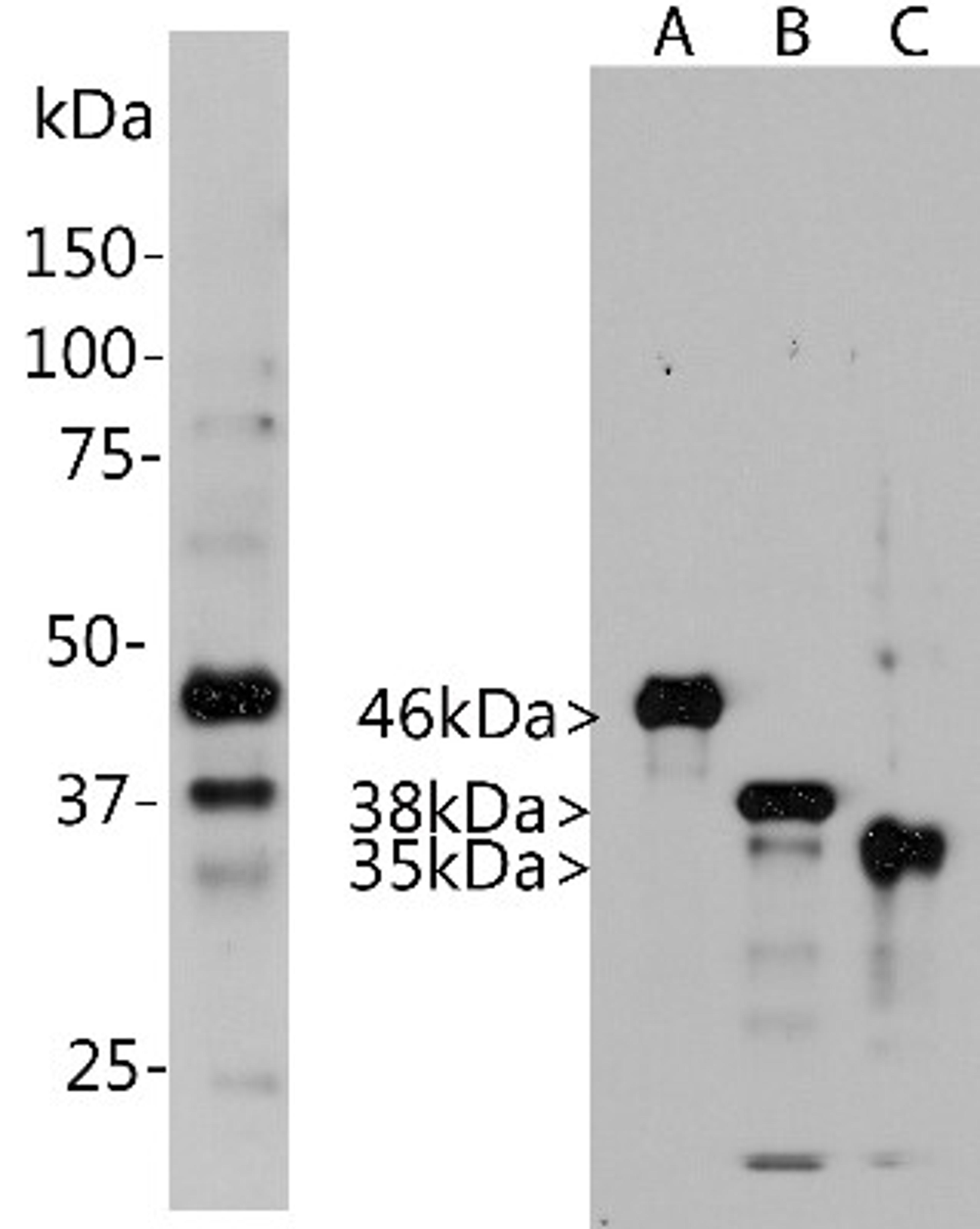 Western Blot: Aurora A/B/C Antibody (4A7) [NBP2-50046] - Left: Analysis of HeLa cells treated with 100ng/ml nocodazole for 18 hours was probed with NBP2-50046. Nocodazole is a microtubule depolymerizating agent which induces cells to halt at the G2/M phase and also induces Aurora kinase expression. NBP2-50046 binds strongly to bands at about 46 kDa and 38kDa, corresponding to Aurora A and Aurora B. Also, it recognizes a weak band at 35 kDa which is Aurora C.  Right: Blot of recombinant full length human Aurora A, B and C was probed with NBP2-50046.