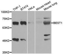 Western blot analysis of extracts of various cell lines using BEST1 antibody