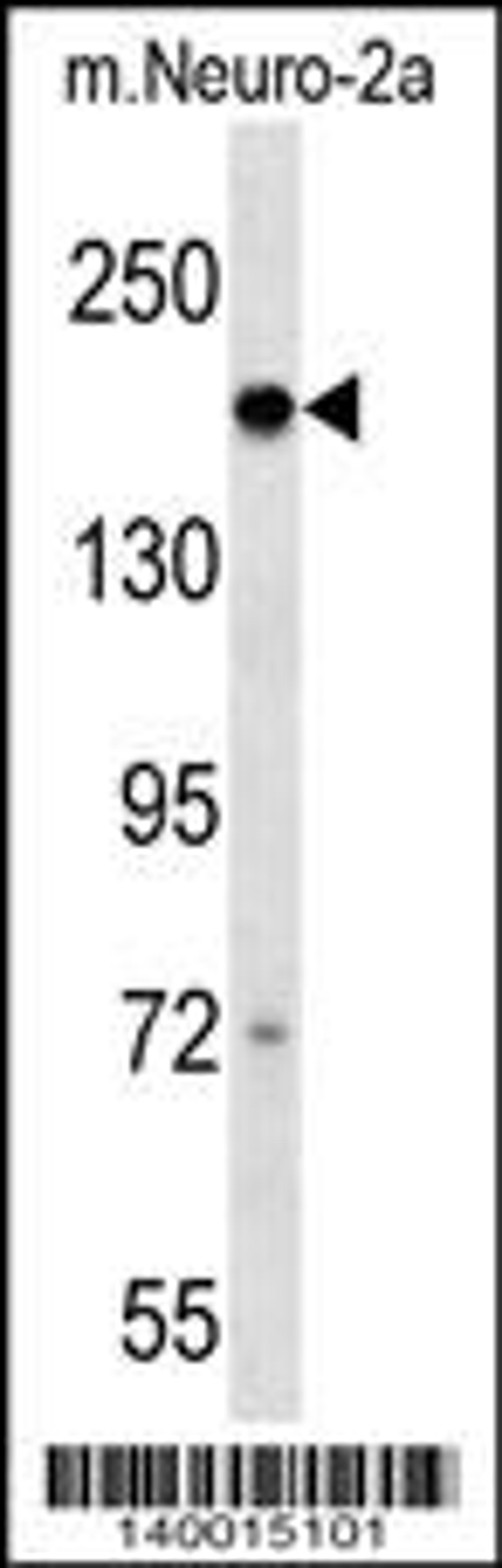 Western blot analysis in mouse Neuro-2a cell line lysates (35ug/lane).This demonstratedetected the Dcc protein (arrow).