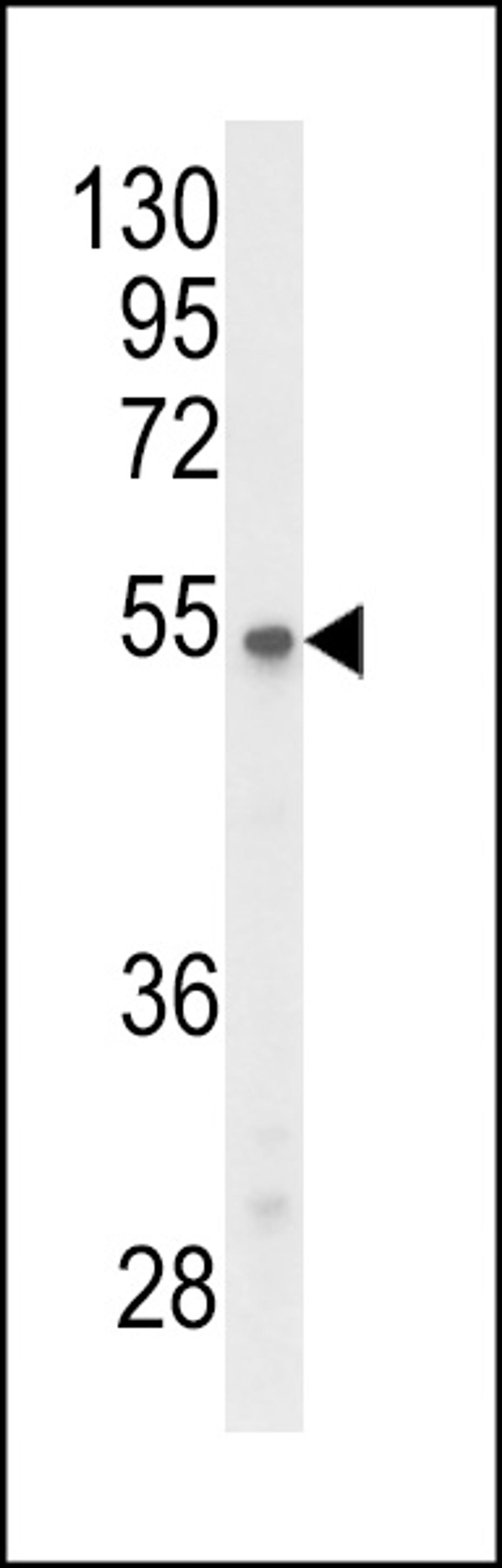 Western blot analysis of P2R3C Antibody in Y79 cell line lysates (35ug/lane)