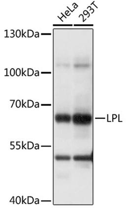 Western blot - LPL antibody (A16252)