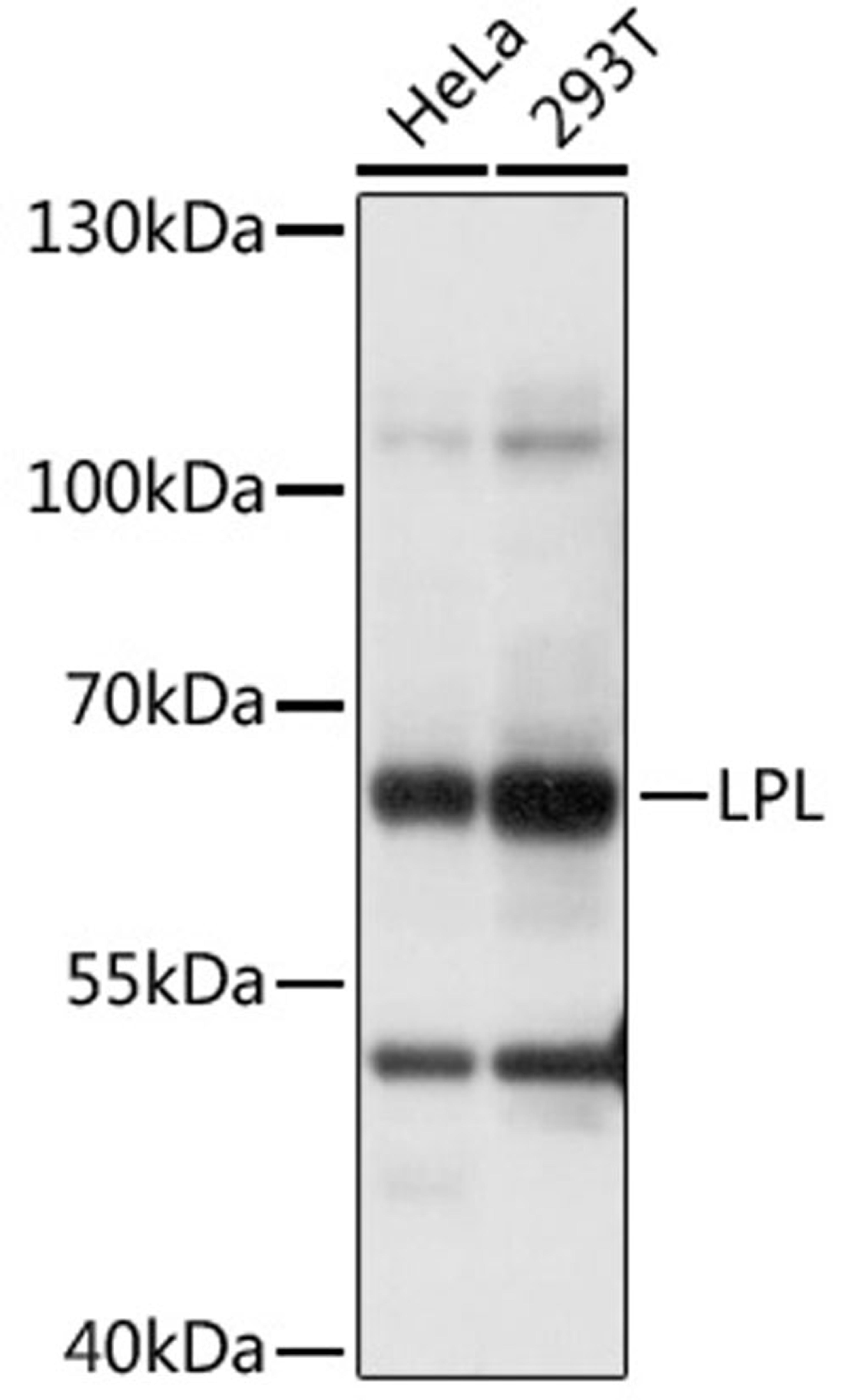 Western blot - LPL antibody (A16252)