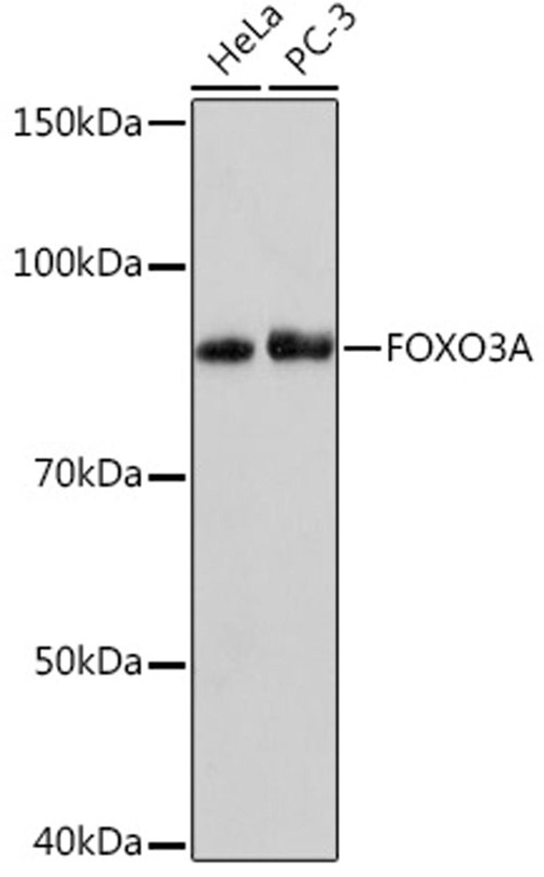 Western blot - FOXO3A Rabbit mAb (A9270)