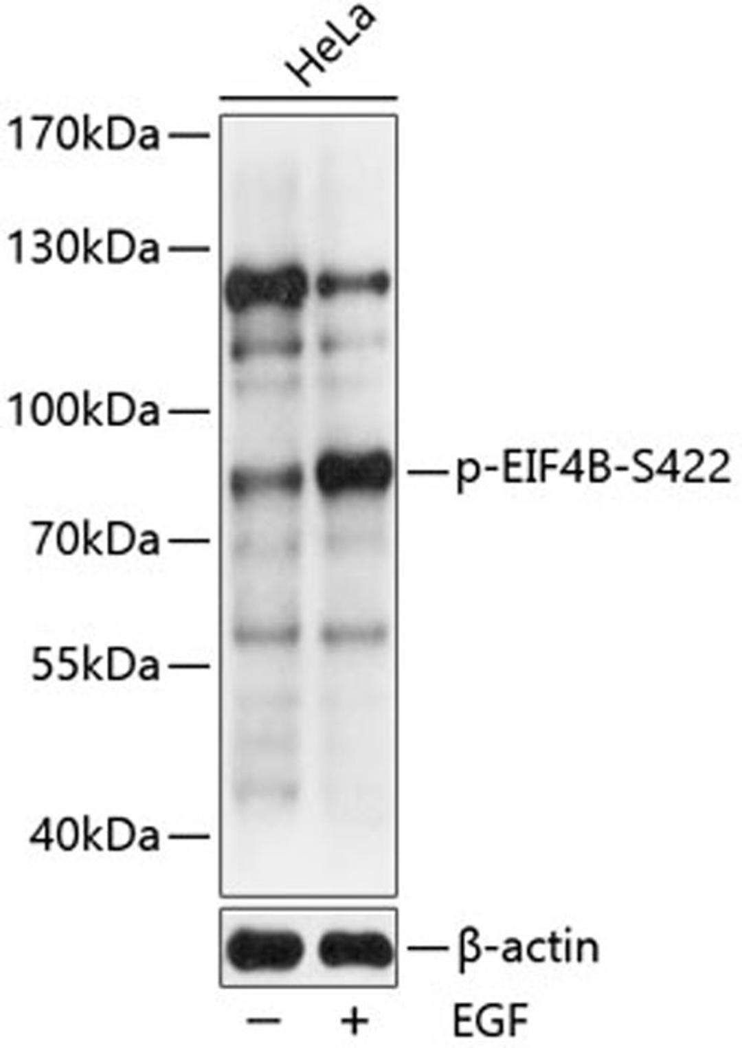 Western blot - Phospho-EIF4B-S422 antibody (AP0775)