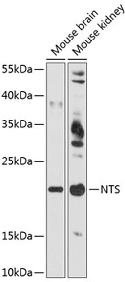 Western blot - NTS antibody (A12326)