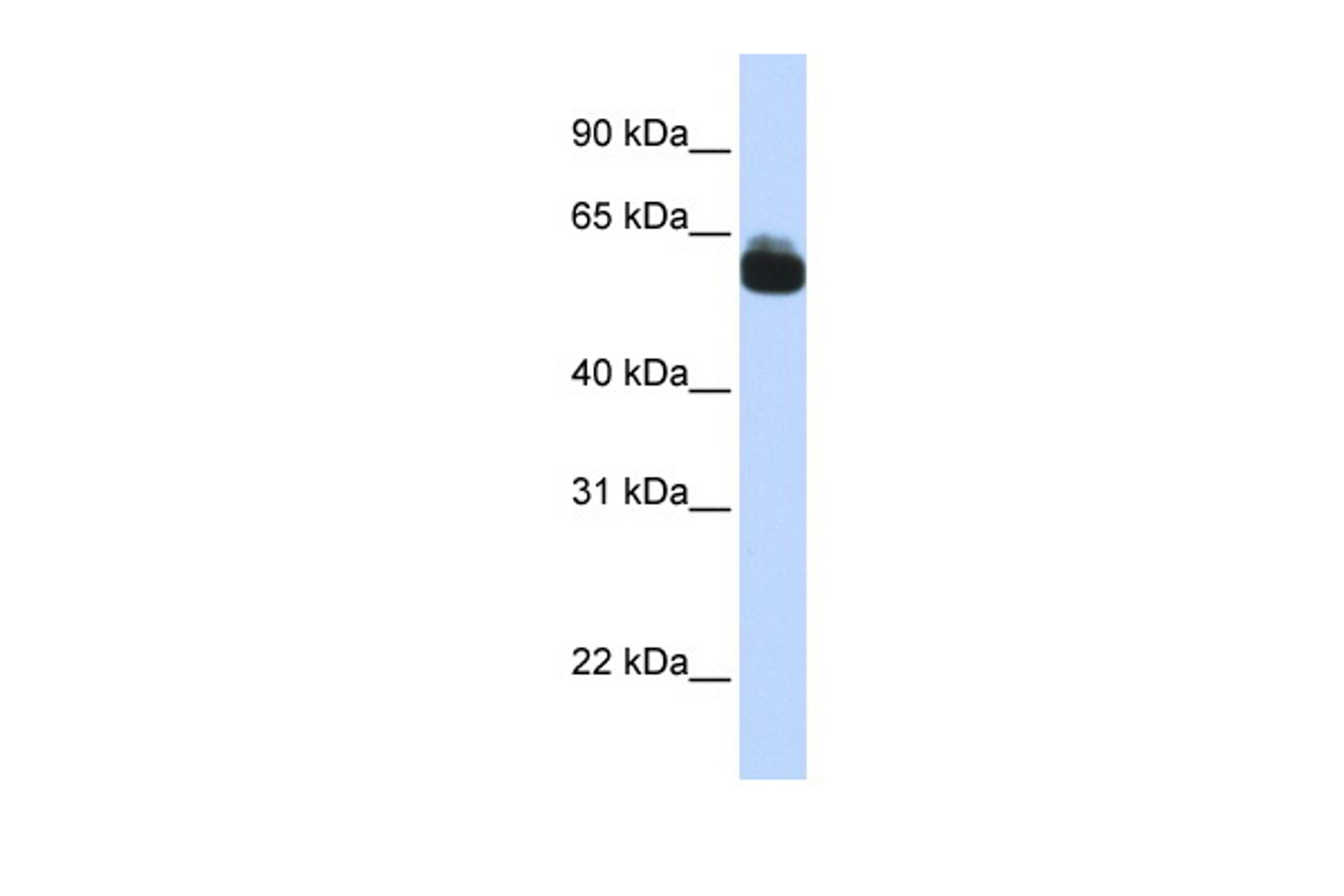 Antibody used in WB on Human Brain at 0.2-1 ug/ml.