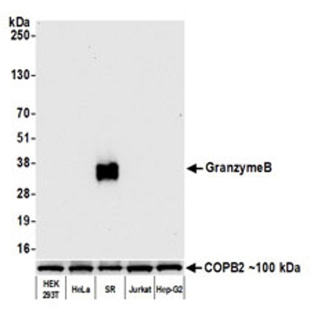 Detection of human Granzyme B by western blot.