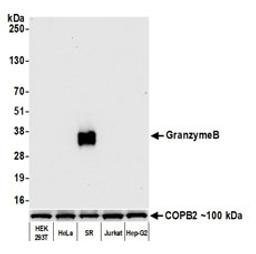 Detection of human Granzyme B by western blot.