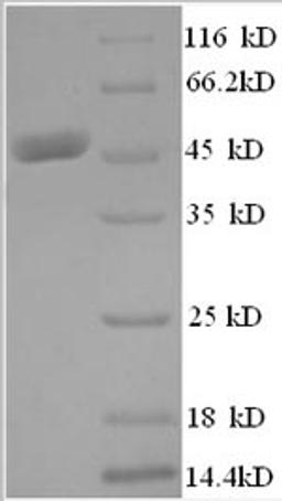 (Tris-Glycine gel) Discontinuous SDS-PAGE (reduced) with 5% enrichment gel and 15% separation gel.