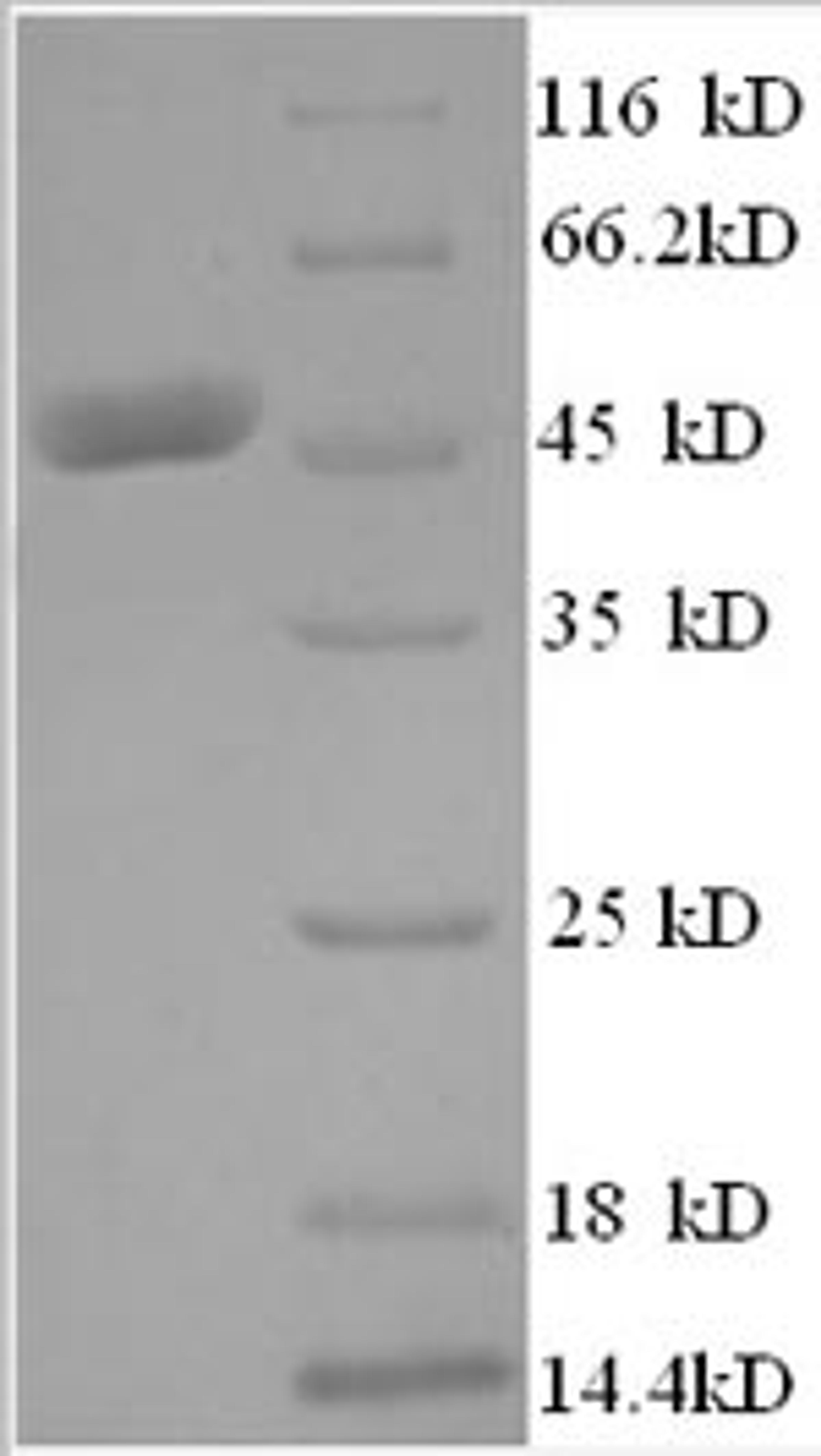 (Tris-Glycine gel) Discontinuous SDS-PAGE (reduced) with 5% enrichment gel and 15% separation gel.