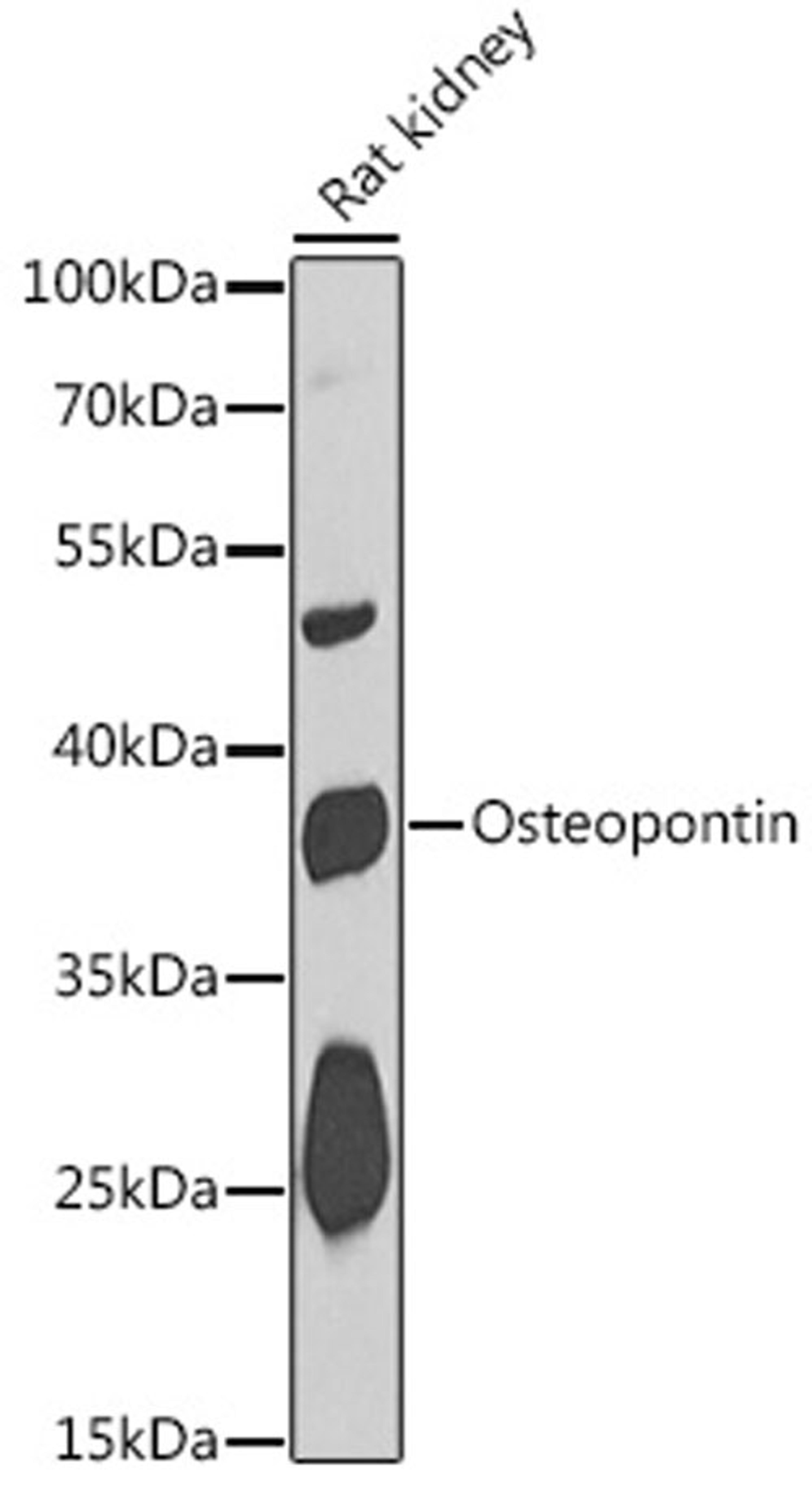 Western blot - Osteopontin antibody (A1499)