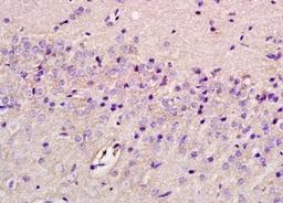 Immunohistochemical analysis of formalin-fixed paraffin embedded rat brain tissue using P2Y1 Receptor antibody (dilution at 1:200)