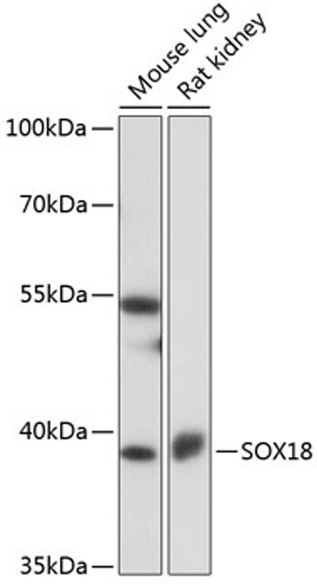 Western blot - SOX18 antibody (A16536)