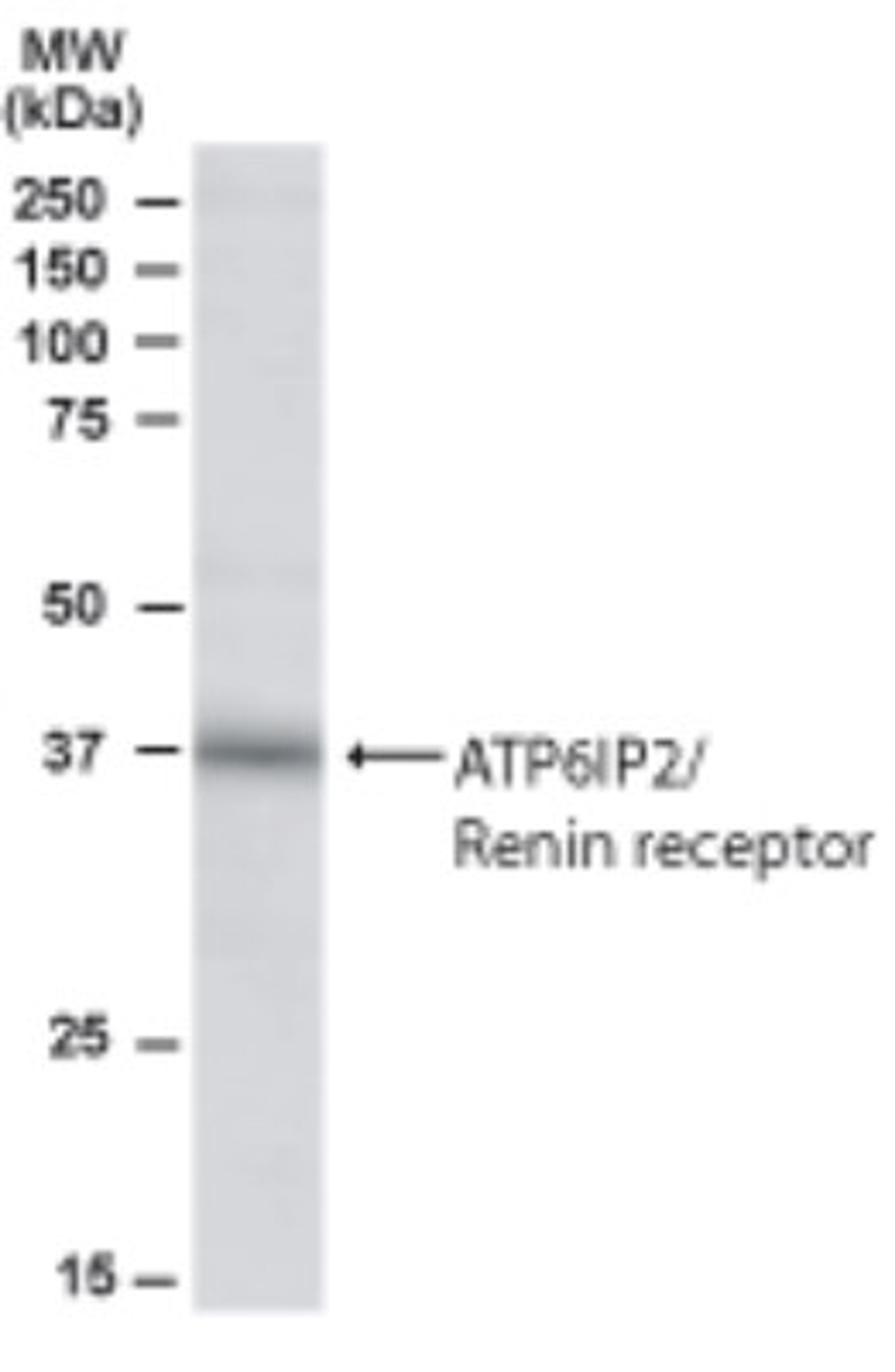 Western Blot: Renin receptor Antibody [NB100-1318] - Western blot analysis of Renin receptor in Human Kidney lysate using at 0.5 ug/ ml.