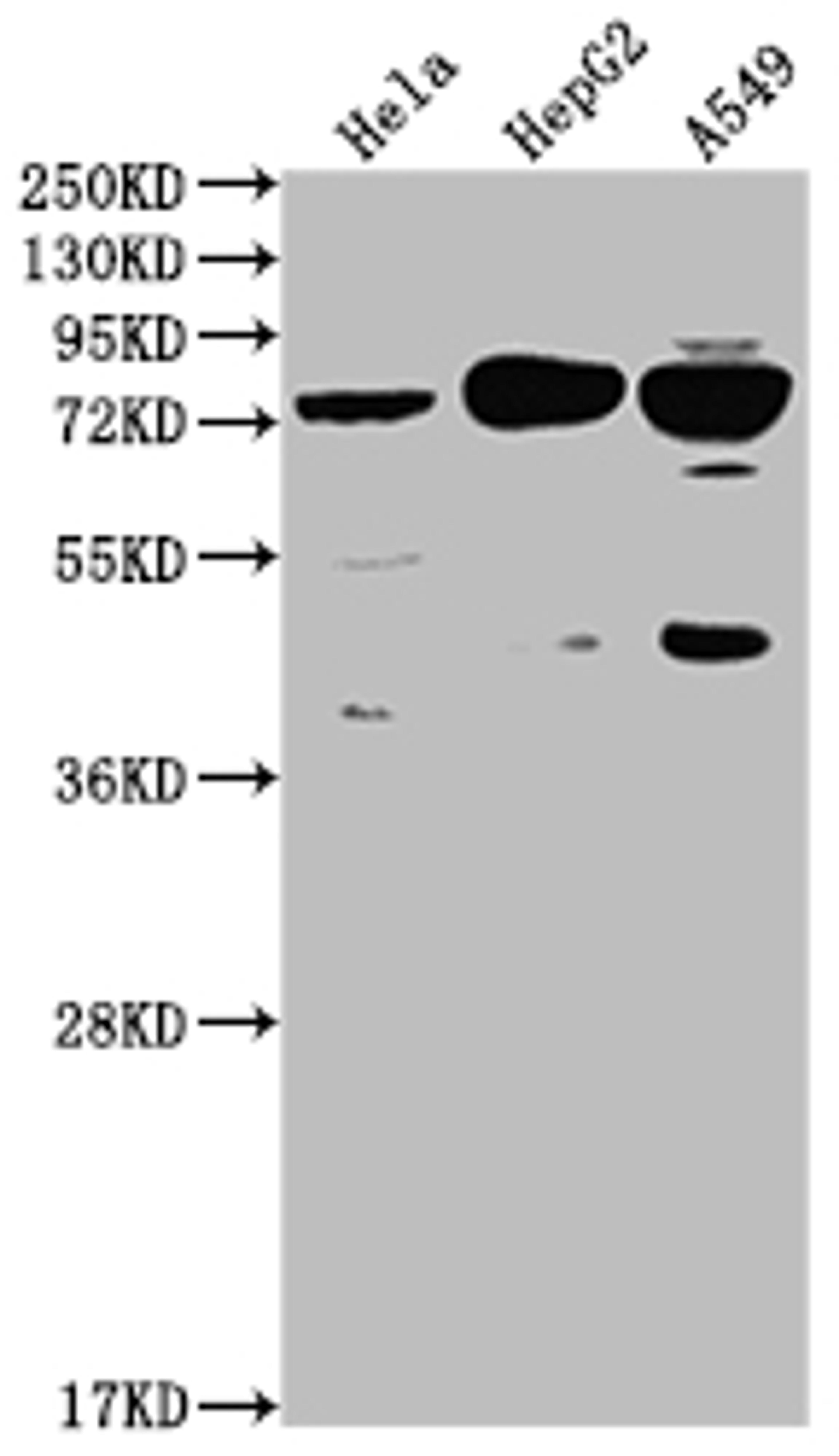 Western Blot. Positive WB detected in: Hela whole cell lysate, HepG2 whole cell lysate, A549 whole cell lysate. All lanes: HTR2C antibody at 1:2000. Secondary. Goat polyclonal to rabbit IgG at 1/50000 dilution. Predicted band size: 52, 29 kDa. Observed band size: 75 kDa. 