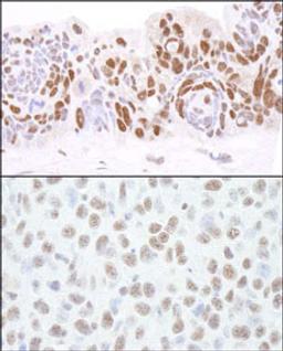 Detection of human and mouse HDAC1 by immunohistochemistry.