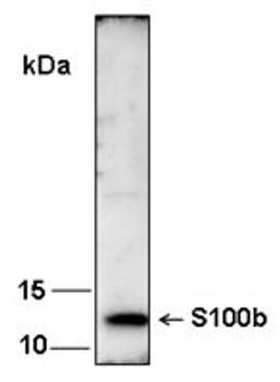 Western blot analysis of recombinant human S100b using S100b antibody (1:1000) 