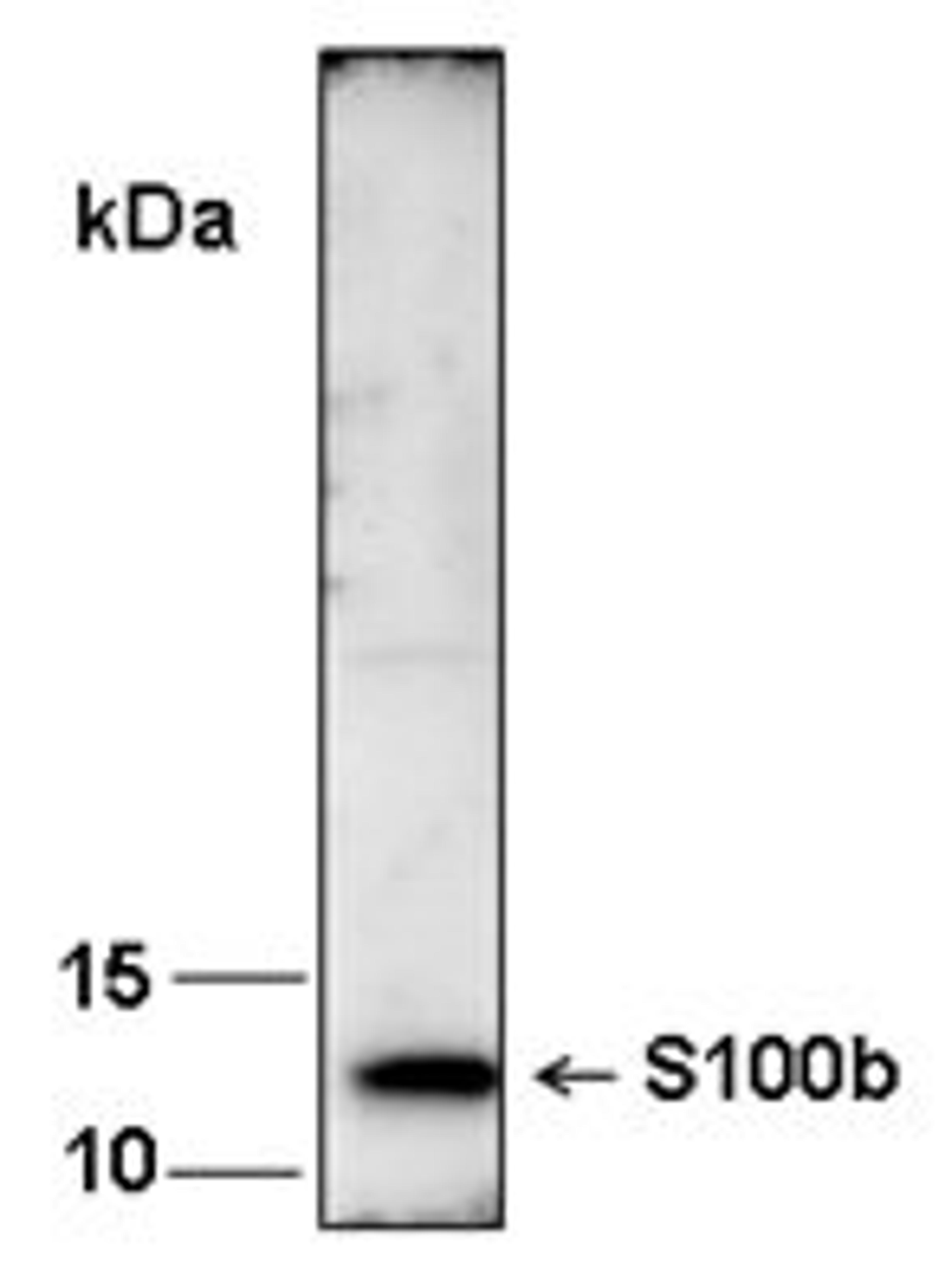 Western blot analysis of recombinant human S100b using S100b antibody (1:1000) 