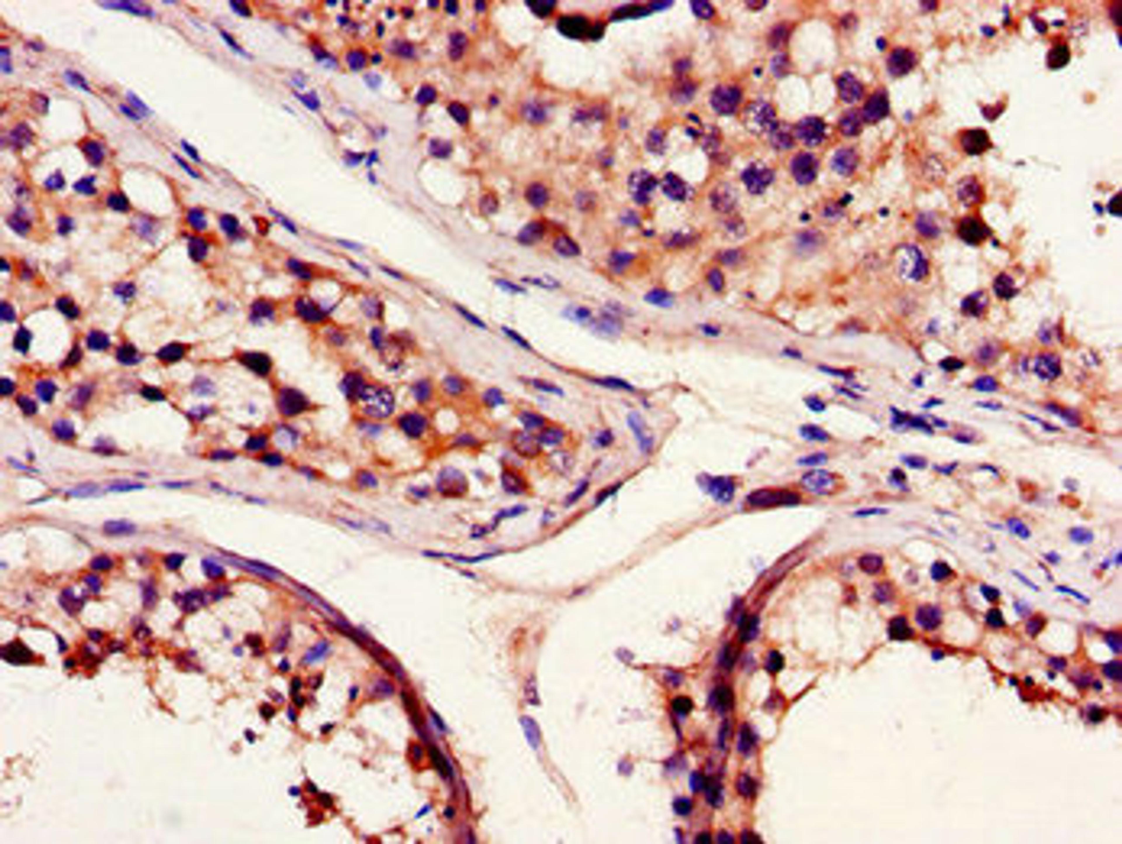 Immunohistochemistry of paraffin-embedded human testis tissue using CSB-PA614974LA01HU at dilution of 1:100