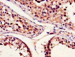 Immunohistochemistry of paraffin-embedded human testis tissue using CSB-PA614974LA01HU at dilution of 1:100