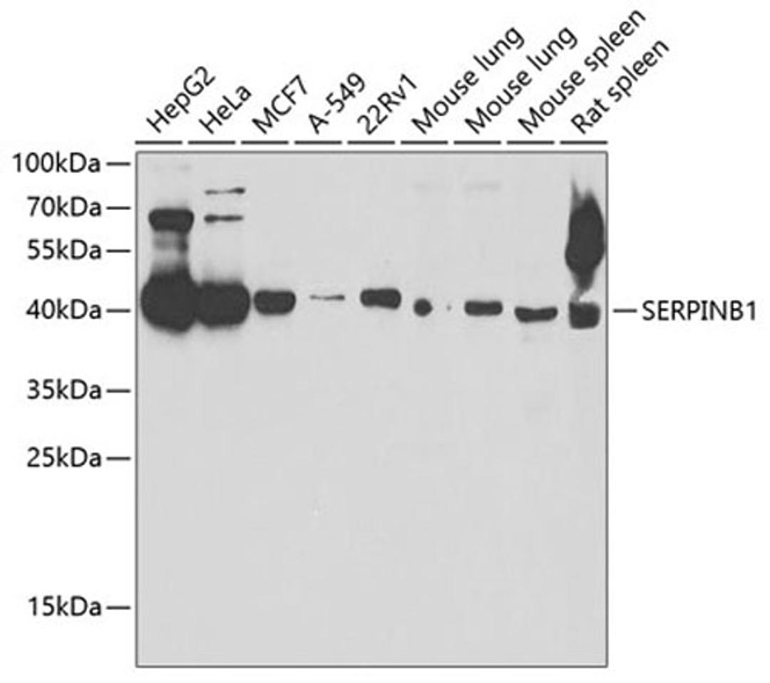 Western blot - SERPINB1 antibody (A6257)