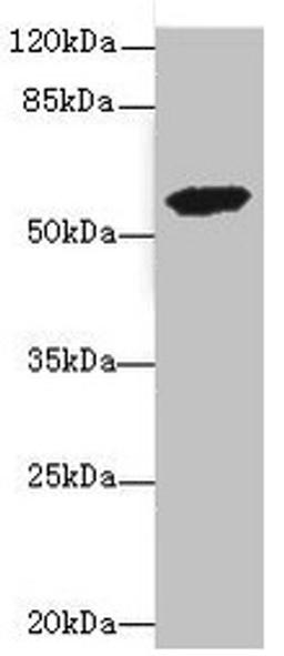 Western blot. All lanes: ETFDH antibody at 3.56µg/ml + 293T whole cell lysate. Secondary. Goat polyclonal to rabbit IgG at 1/10000 dilution. Predicted band size: 69, 63 kDa. Observed band size: 63 kDa